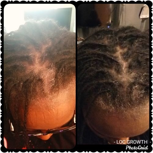 Customer photo review of Hair Growth Serum | 1 oz