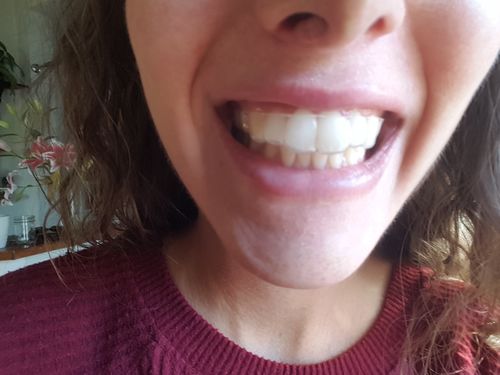 Customer photo review of Night Guard