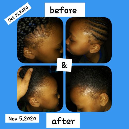 Customer photo review of Nae Nae's Hair Boost 9oz