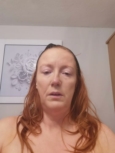 Customer photo review of Rosalique 3 in 1 Anti-Redness Miracle Formula SPF50