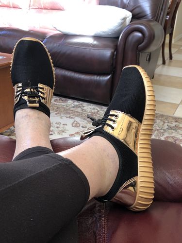 Customer photo review of Astra Sneakers - Instant Foot Pain Relief