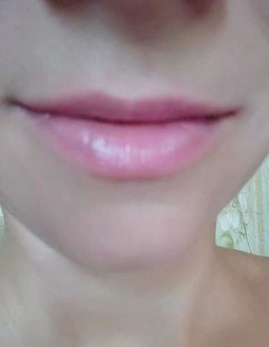 Customer photo review of AloeLips™ - Kleur Veranderende Aloë Vera Lippenbalsem