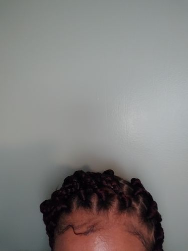 Customer photo review of PureFix Hair Elixir