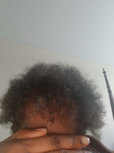 Customer photo review of PureFix Hair Elixir