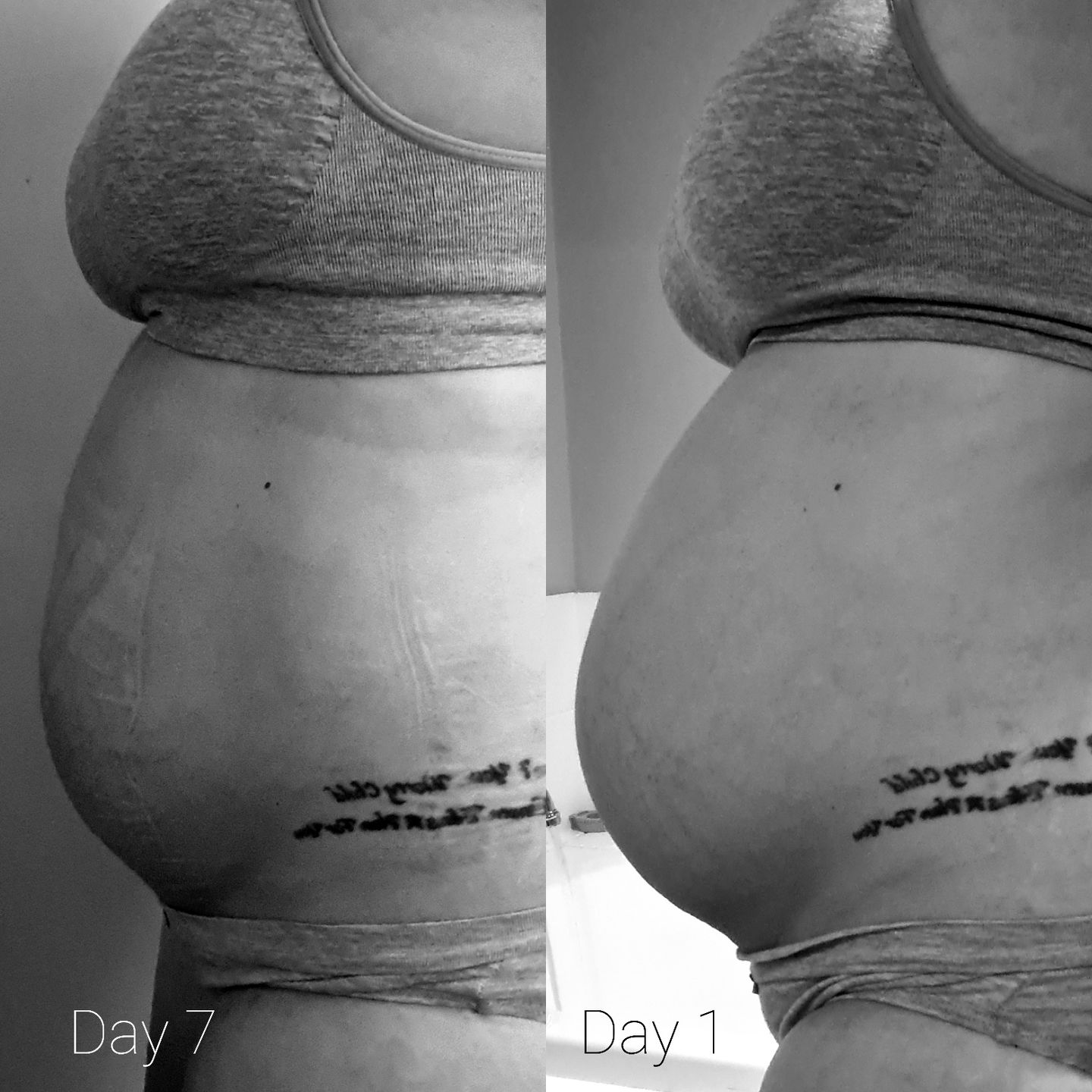 Customer photo review of Postpartum Belly Band