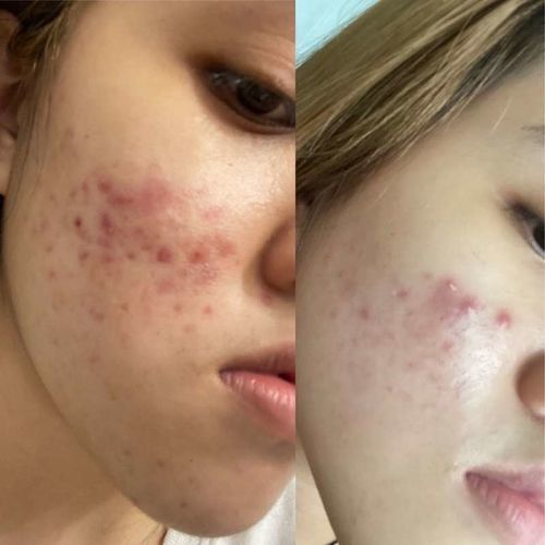 Customer photo review of CLEF RADIANT GOLD ESSENCE (30ml)