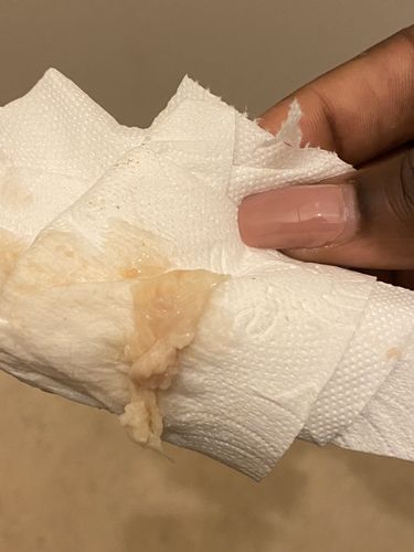 Customer photo review of Perle de Detox Vaginale (Lot de 3 perles par sachet)