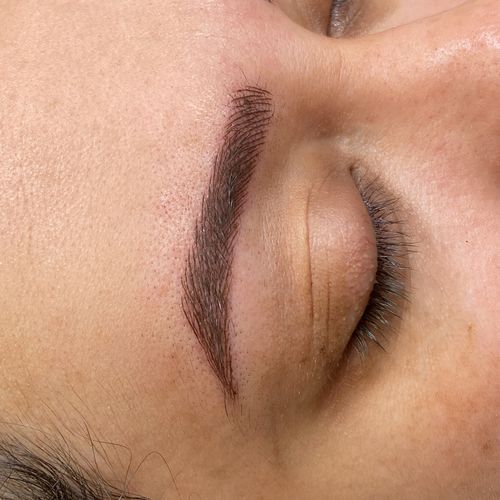 Customer photo review of Numb - Pre Procedure