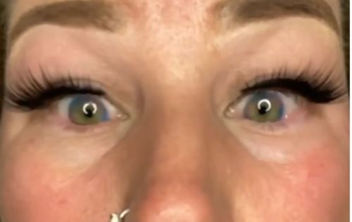 Customer photo review of Icoloured® Mermaid Tears Pink Colored Contact Lenses