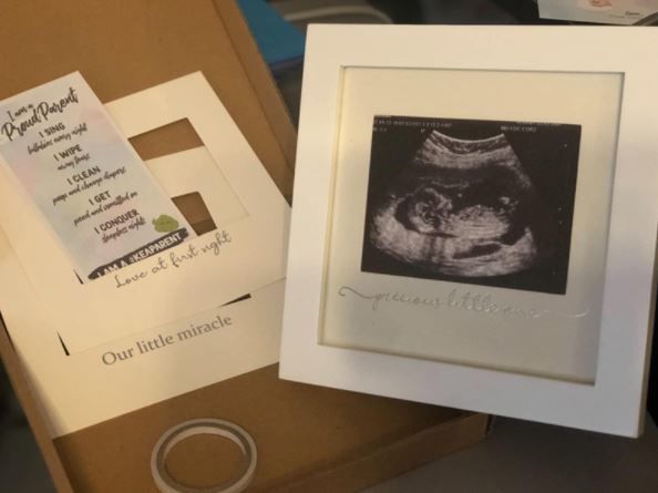 Customer photo review of Baby Sonogram Picture Frame
