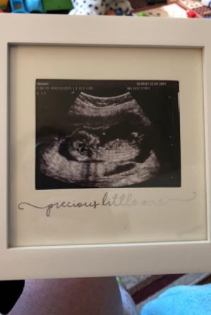 Customer photo review of Baby Sonogram Picture Frame