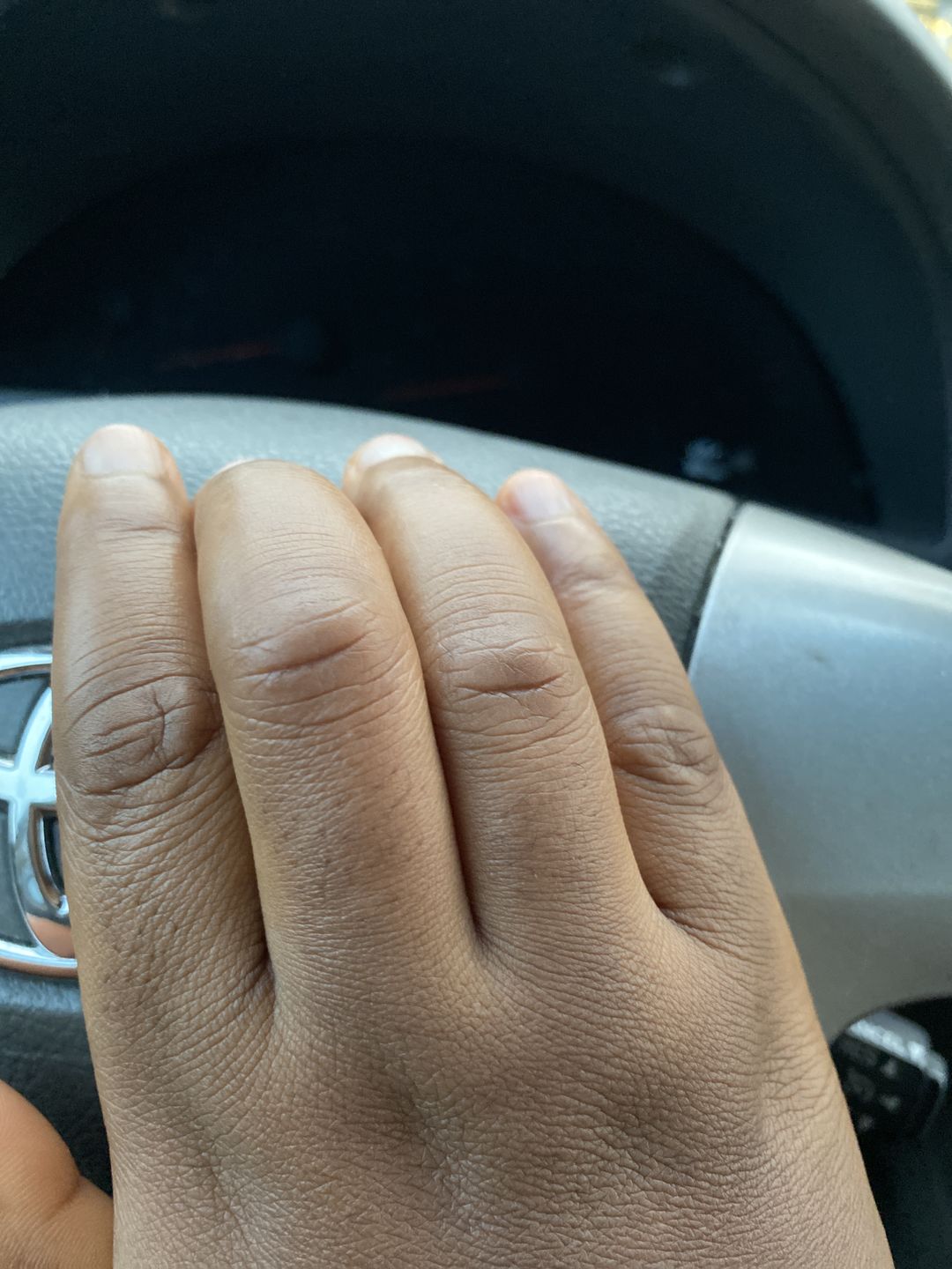 Customer photo review of Fair and White So White Skin Perfector Purifying Cream 250ml / 8.4 fl oz