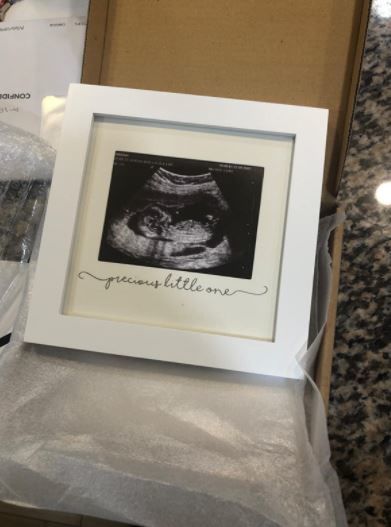 Customer photo review of Baby Sonogram Picture Frame