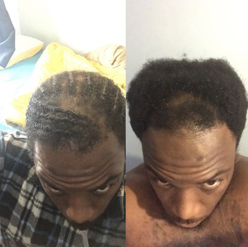 Customer photo review of Growth & Volume Duo -  Moisture & Seal