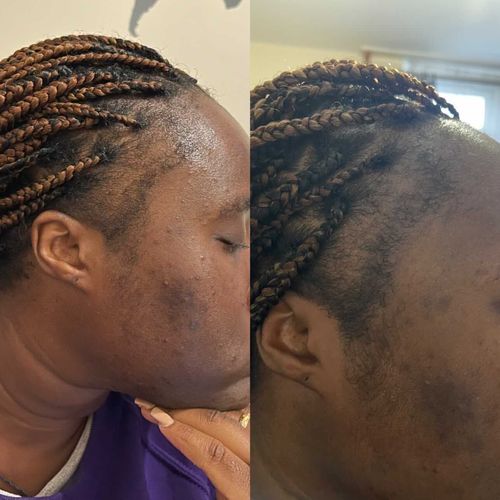 Customer photo review of Inches - Hair & Beard Growth Oil