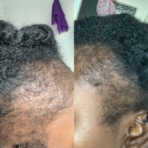 Customer photo review of Inches - Hair & Beard Growth Oil