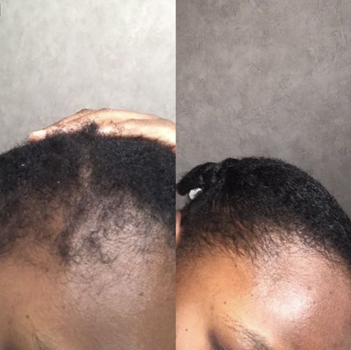 Customer photo review of Inches - Hair & Beard Growth Oil