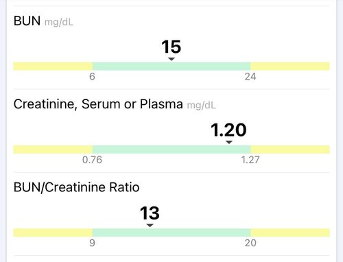 Customer photo review of Kidney