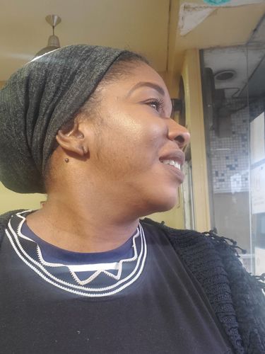 Customer photo review of POWERFUL® Face Whitening Cream