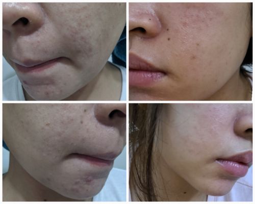 Customer photo review of Niacid