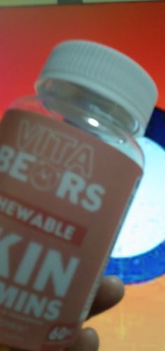Customer photo review of Skin Vitamin Gummies