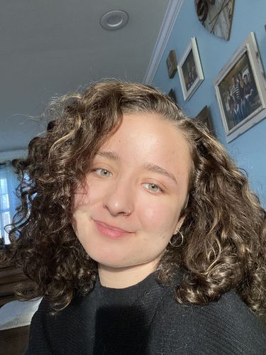 Customer photo review of (BOGO) AWAKEN: Skin Repair Intensive Healing Serum