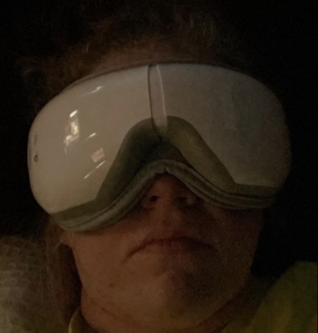Customer photo review of Eyeology™ Intelligent Eye Massager