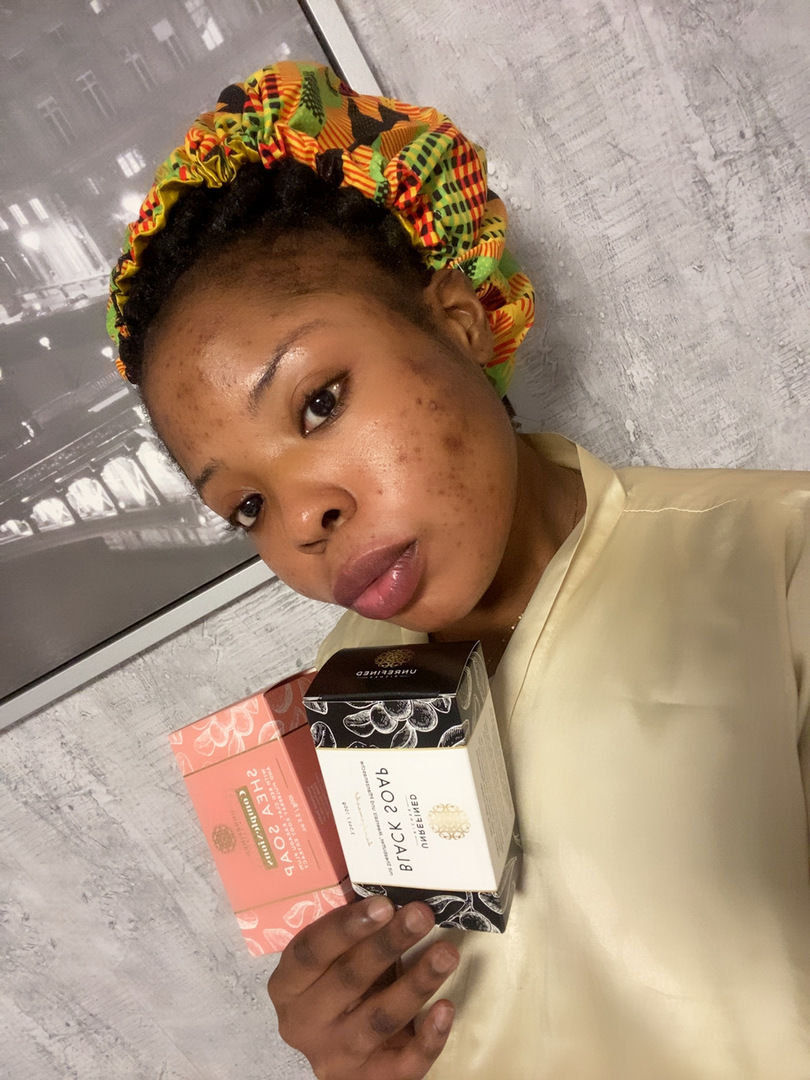 Customer photo review of SHEA SOAP