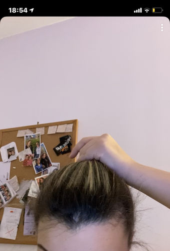 Customer photo review of Good Hair Vitamins - 3 mois