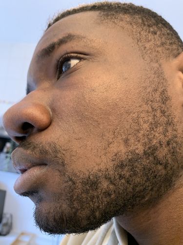 Customer photo review of BLACK SOAP - afrikanische schwarze Seife