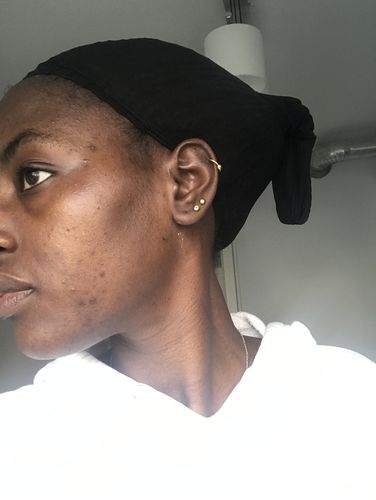 Customer photo review of GLOW DUOs