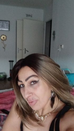 Customer photo review of L'huile de Pépins de Figue de Barbarie 100% Bio 30ML