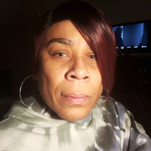 Customer photo review of [US Warehouse] Elite Snow Flake Contact Lenses