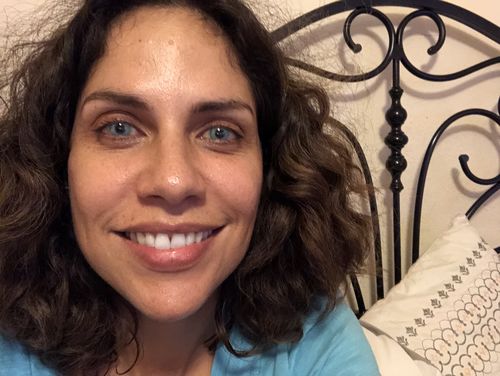 Customer photo review of [US Warehouse] Topaz Prescription Contact Lenses