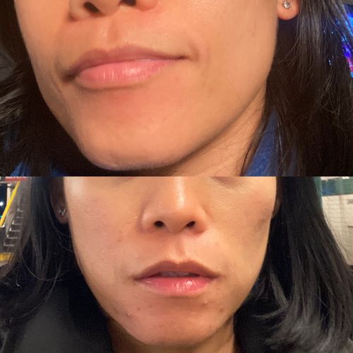 Customer photo review of AWAKEN: Skin Repair Intensive Healing Serum