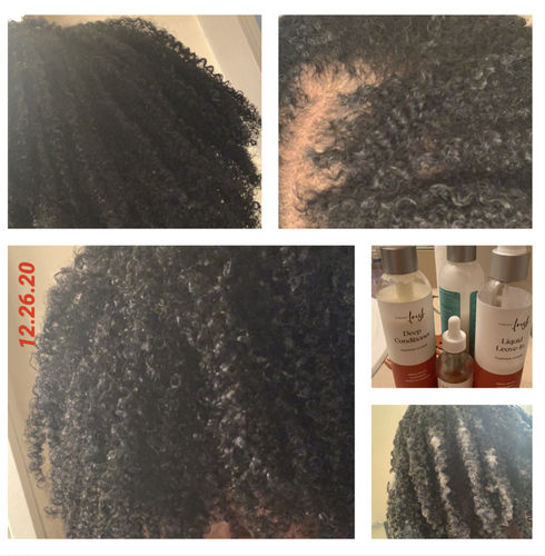 Customer photo review of LIMITED TIME - Pumpkin Power Kit for Enhanced Hair Growth (4 Items)