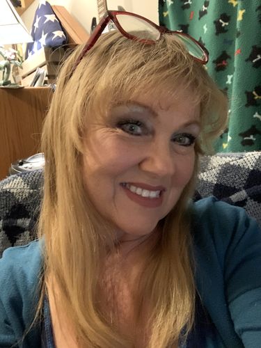 Customer photo review of Topaz Prescription Contact Lenses