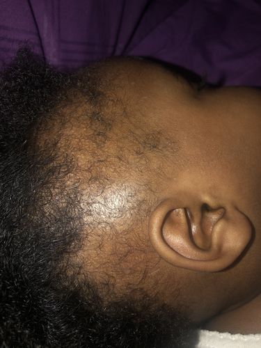 Customer photo review of Nae Nae's 9oz Hair Boost Special