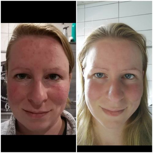 Customer photo review of Cleoglam Enzyme Peeling Maske 29g -   7 Wochen Erneuerungskur