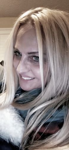 Customer photo review of Cherry Ocean Prescription Contact Lenses