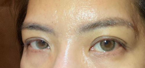 Customer photo review of Terve Khaki (2pcs) (Buy 1 Get 1 Free) 1Monthly G.DIA 13.4mm