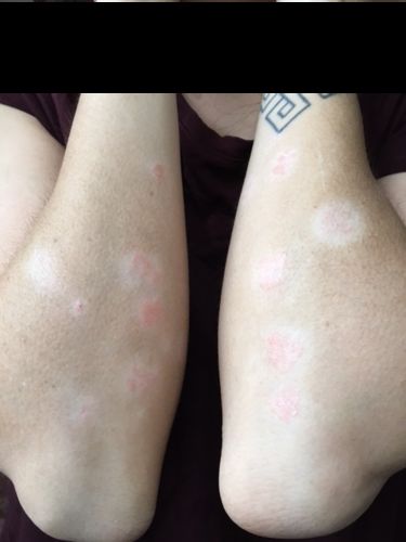 Customer photo review of Body Cream with Chia Oil