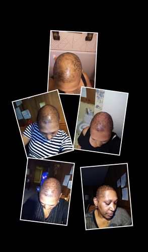 Customer photo review of PureFix Hair Elixir