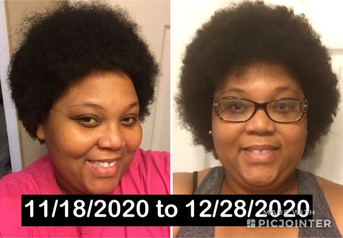 Customer photo review of Nae Nae's Hair Boost 9oz