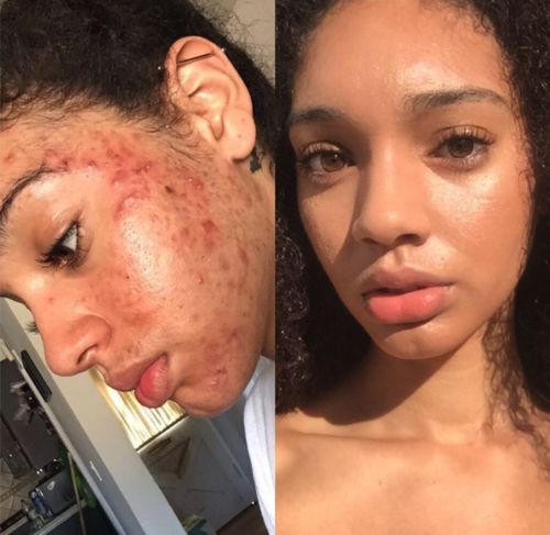 Customer photo review of Ziegenmilch Bio-Masken-Seife TEINT PRÉCIEUX von MaggyBeauty