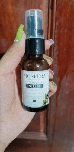 Customer photo review of St John's Wort Oil Serum