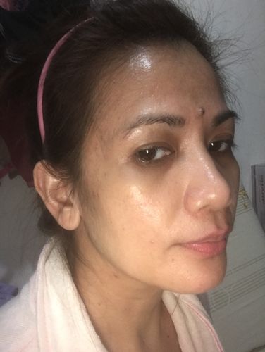 Customer photo review of Niacid