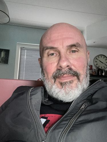 Customer photo review of PositVibe Patella Stabilizer