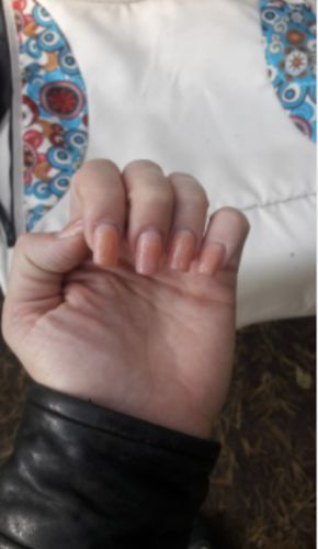 Customer photo review of GROUNDBREAKING  NAIL EXTENSION KIT - UP TO 50% OFF LAST DAY PROMOTION!