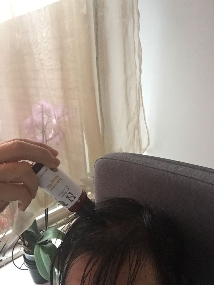 Customer photo review of Scalp Oil